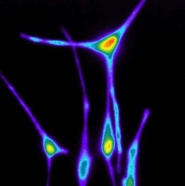 皮肤“看见”紫外线，还能产生色素